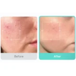 flacon sérum acide azélaïque Medicube niacinamide peau apaisée