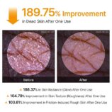 Dr.Melaxin Peel Shot Exfoliating Kojic Acid Turmeric Spray 200ml5