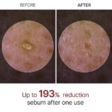 Dr.Melaxin Peel Shot Exfoliating White Rice Ampoule 80ml2