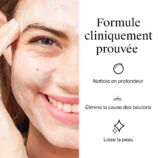 Neutrogena (3 versions) — Anti-Boutons Gel Nettoyant2