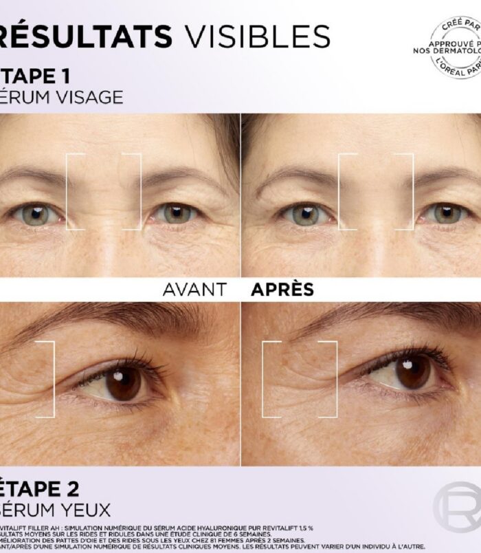 Sérum yeux L'Oréal Revitalift2